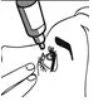Disegno schematico che mostra l'applicazione di un applicatore medico sulla pelle del viso vicino all'occhio con le dita che tengono la zona