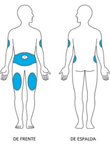Diagramma del corpo umano che mostra zone blu su addome, braccia e cosce nella vista frontale e su braccia e fianchi nella vista posteriore