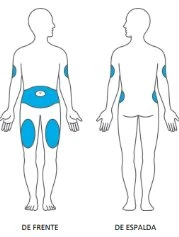 Diagramma di un corpo umano visto di fronte e di spalle con aree blu su braccia, addome e cosce che indicano i siti di applicazione del farmaco