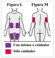 Medical diagram with two human figures, one front view and one back view, with purple and red colored areas indicating injection sites