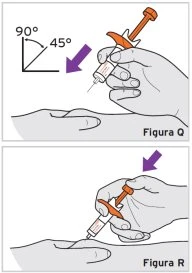 Diagram showing two methods of syringe injection: at a 45-degree angle and at a 90-degree angle relative to the arm skin