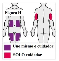 Diagramma con figure umane che mostrano zone di applicazione viola sull'addome e sulle cosce e zone rosse sulle braccia con relativa legenda