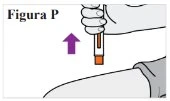 Una mano impugna un dispositivo medico con una freccia viola rivolta verso l'alto sopra una gamba per indicare il movimento di estrazione