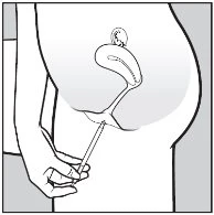 Schematic drawing of a hand inserting a slender applicator into the vaginal cavity of a female figure in profile