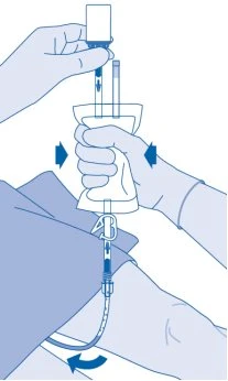 Two gloved hands manipulating an infusion bag connected to flexible tubing above a patient's leg during a medical procedure