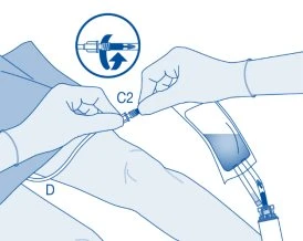 Medical illustration showing two gloved hands connecting a tube with connector D to device C2 with rotational movement indicated by an arrow