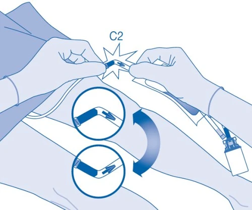 Medical diagram showing two hands bending an L-shaped device with curved arrows indicating downward flexion movement