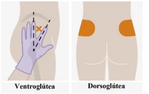 Diagramma medico che mostra due zone per iniezioni intramuscolari sul gluteo, denominate ventroglutea e dorsoglutea con indicazioni grafiche