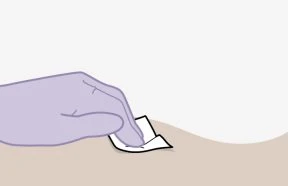Una mano guantata di viola solleva delicatamente l'angolo di un piccolo cerotto adesivo applicato sulla pelle chiara