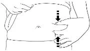 Disegno schematico di una mano che pizzica la pelle dell'addome creando una piega per la somministrazione di un'iniezione sottocutanea