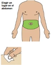 Diagram of a male torso with a