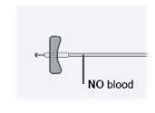Technical diagram of a medical device with a vertical black line and the text 'NO blood' next to the central part of the tube