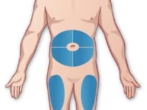 Diagramma del torace maschile con aree blu circolari sull'addome