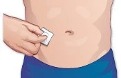 Una mano applica un piccolo cerotto bianco sulla pelle dell'addome