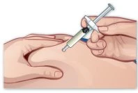 Una mano tiene una siringa con ago e liquido mentre viene inserita nel tessuto adiposo dell'addome
