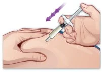 Una mano tiene una siringa inclinata e la inserisce nel gluteo di un paziente mentre l'altra mano tiene ferma la pelle