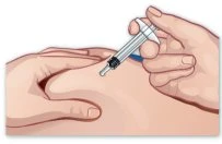 Una mano tiene una siringa e inserisce l'ago nel muscolo deltoide del braccio