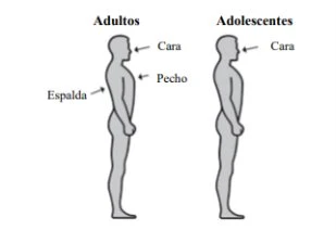 Diagram with lateral profiles of an adult and an adolescent showing face, chest, and back areas for drug administration