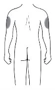 Disegno schematico del retro di un corpo umano con due aree grigie che indicano zone di applicazione sulle braccia e sulla parte bassa della schiena