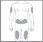 Schema del corpo maschile con aree grigie che indicano i siti di applicazione del farmaco sulle braccia, sull'addome e sulle cosce
