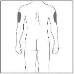 Disegno schematico del corpo umano visto di schiena con due aree grigie evidenziate sulla parte superiore di entrambe le braccia