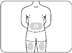 Disegno schematico di un busto umano con aree grigie evidenziate sull'addome e sulla parte superiore delle cosce per indicare i siti di iniezione