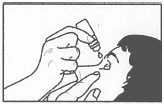 Una mano tiene un flacone per far cadere una goccia di medicinale nell'occhio di una persona mentre l'altra mano sostiene delicatamente il viso