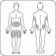 Schematic drawing of a human body shown front and back with gray areas indicating drug injection sites on abdomen and thighs