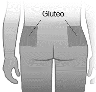 Diagramma medico che mostra la parte posteriore di un corpo umano con due aree rettangolari evidenziate sui glutei e la scritta Gluteo