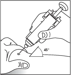 A hand holds a medical device to insert a needle into the skin at a 45-degree angle indicated by a dashed line