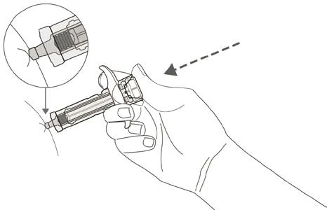 A hand holding a medical device for the