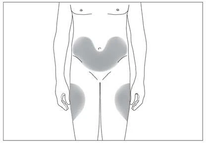 Schematic drawing of a human body with gray areas indicating application zones on the