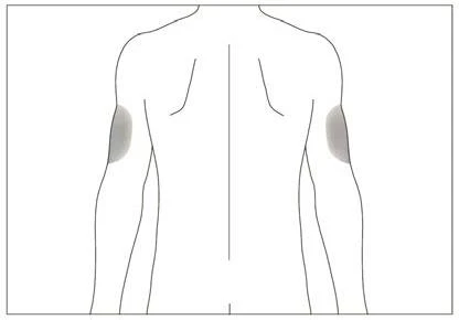 Linear diagram of a person's torso and arms viewed from the back with two gray areas indicating injection sites on the arms