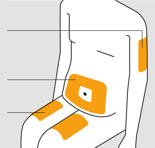 Diagrama esquemático de un cuerpo humano con cuatro áreas resaltadas en naranja en el brazo, indicando posibles sitios de inyección.