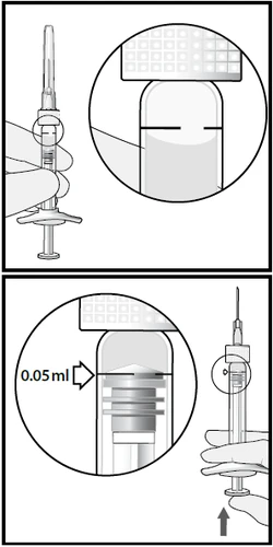 Medical diagram showing two stages of