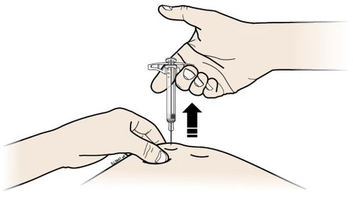 A hand holds a syringe inserting it into the skin while the