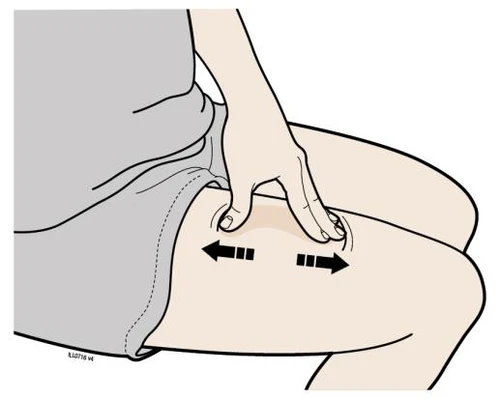 A hand presses the skin of the thigh with two fingers while two black arrows indicate lateral skin stretching movement