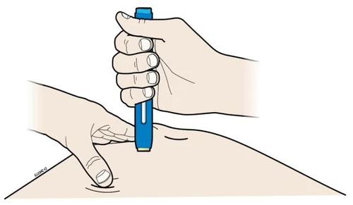 A hand holds a blue injection pen to apply it to the skin of the