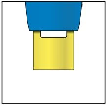 Schematic illustration of a medical device composed of an upper blue part and a yellow rectangular base on a white background