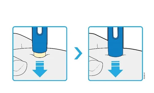Two diagrams show the