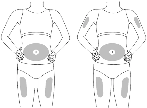 Drawing of two human figures showing drug application sites on the body