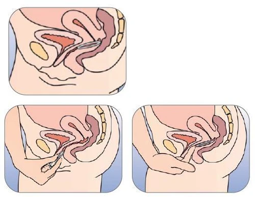 Diagrama médico que muestra la