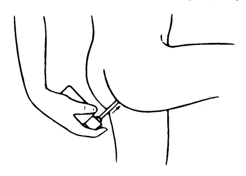 Disegno lineare che mostra una mano che tiene una siringa per iniettare un farmaco nella parte superiore della coscia di una persona