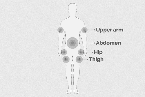 Human silhouette with gray circles indicating injection sites: upper arm, abdomen, hip, and thigh, with corresponding English labels