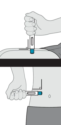 Medical illustration showing two methods of using an injection pen on the skin of the