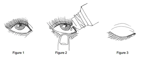 Tre disegni sequenziali che mostrano un occhio aperto, l'applicazione di un collirio con un dito che abbassa la palpebra inferiore e l'occhio chiuso