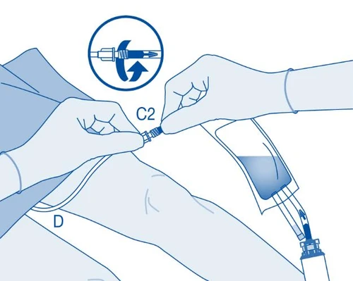 Illustrazione blu che mostra due mani guantate che ruotano un connettore C2 per collegare un flacone di liquido a un tubo flessibile contrassegnato con D