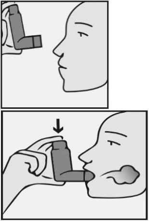 Dibujo en dos partes que muestra un perfil humano acercando un inhalador a la boca y luego introduciéndolo para inhalar el medicamento