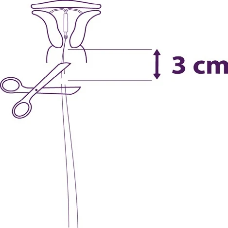 Diagramma medico che mostra un paio di forbici che tagliano un tubicino a 3 cm dalla base di un dispositivo medico viola su sfondo bianco
