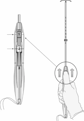 Diagramma tecnico di un dispositivo medico con ingrandimento laterale che indica tre componenti numerate 1, 2 e 3 e una mano che lo impugna